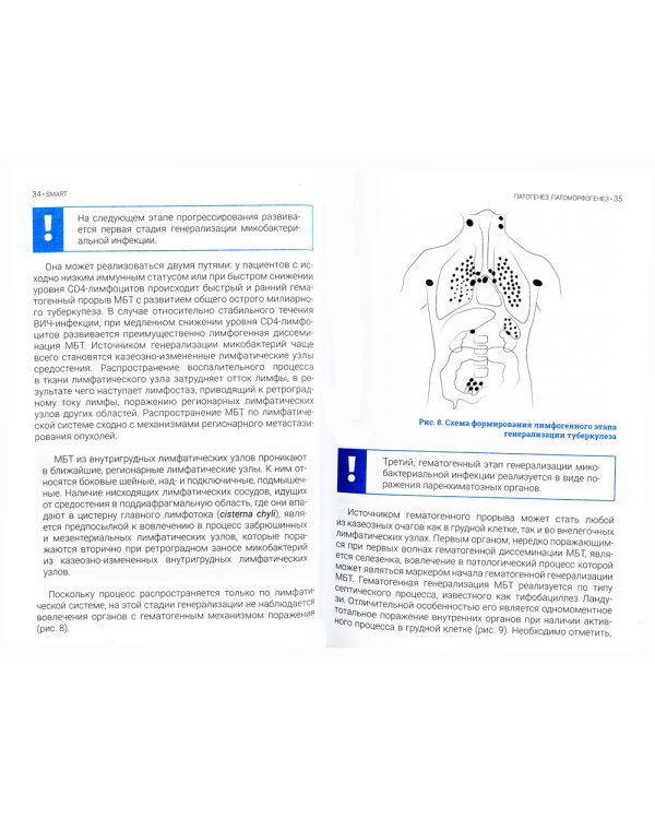 Туберкулез и ВИЧ-инфекция