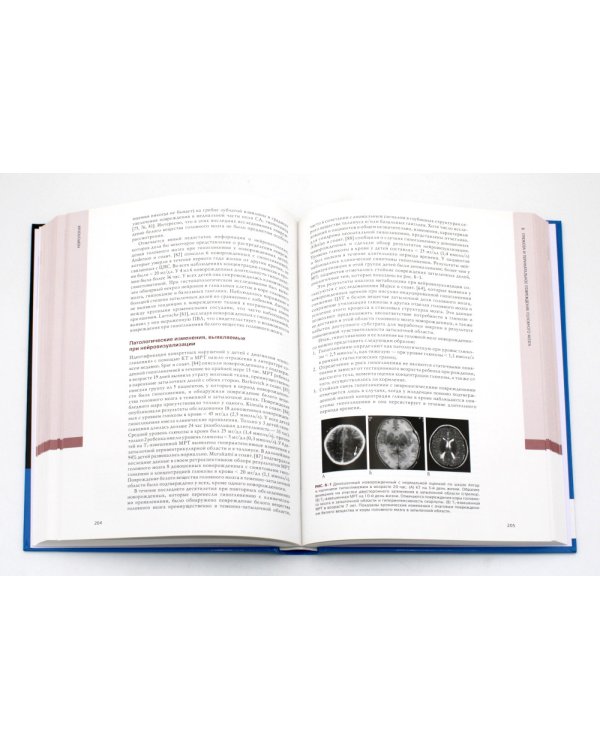 Неврология. Проблемы и противоречия в неонатологии