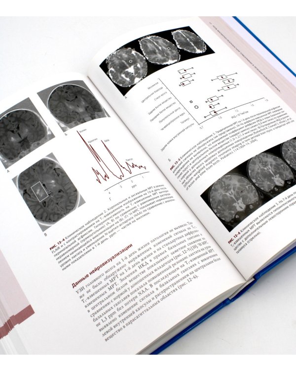 Неврология. Проблемы и противоречия в неонатологии