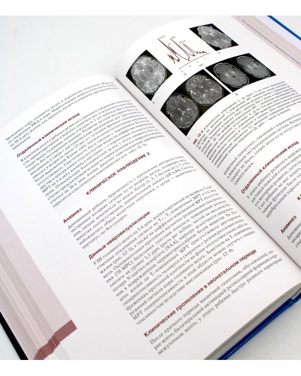 Неврология. Проблемы и противоречия в неонатологии