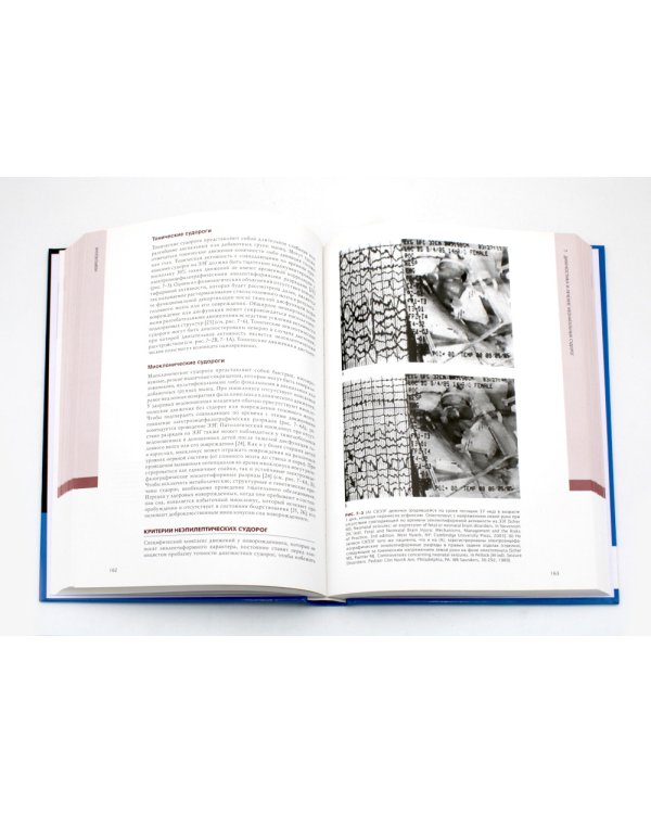 Неврология. Проблемы и противоречия в неонатологии