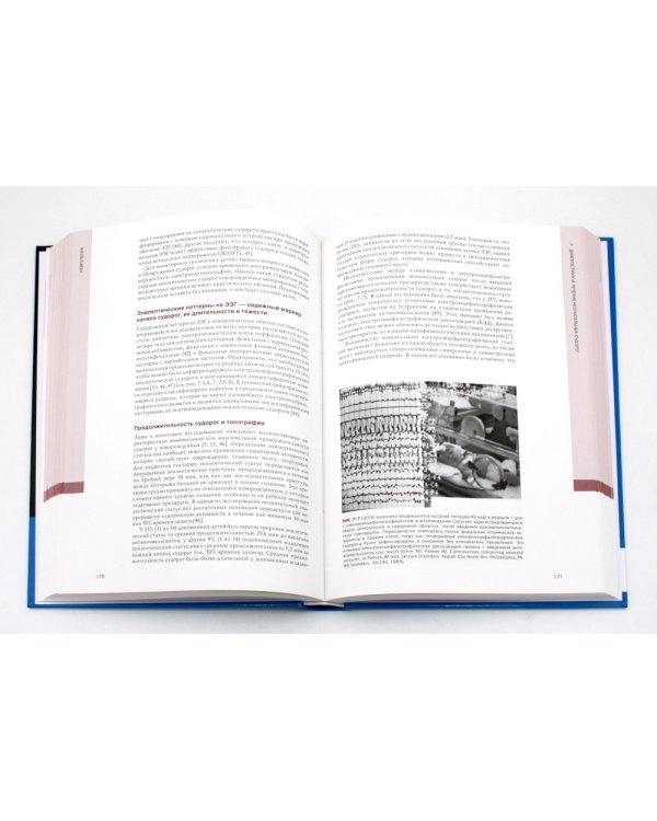 Неврология. Проблемы и противоречия в неонатологии