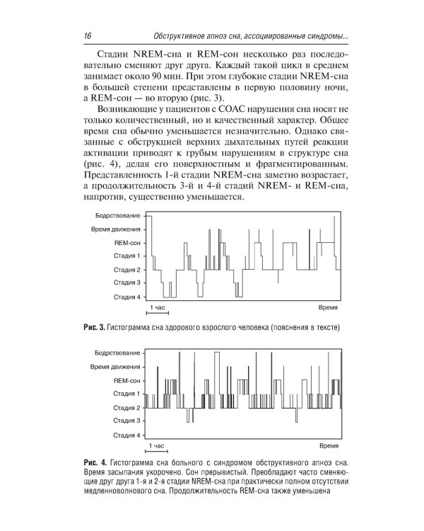 Обструктивное апноэ сна. Ассоциированные синдромы и клинические состояния: практическое пособие для врачей