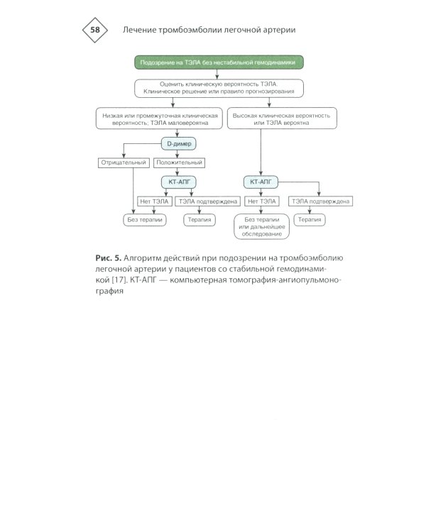 Венозные тромбоэмболические осложнения. Антикоагулянтная терапия в таблицах и схемах. 2-е изд., перераб.и доп