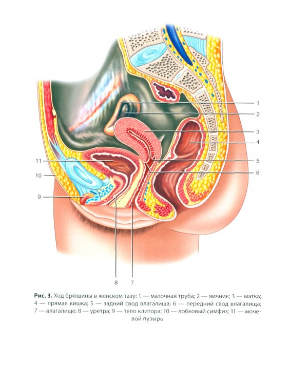 Хроническая тазовая боль: клиника, диагностика, лечение