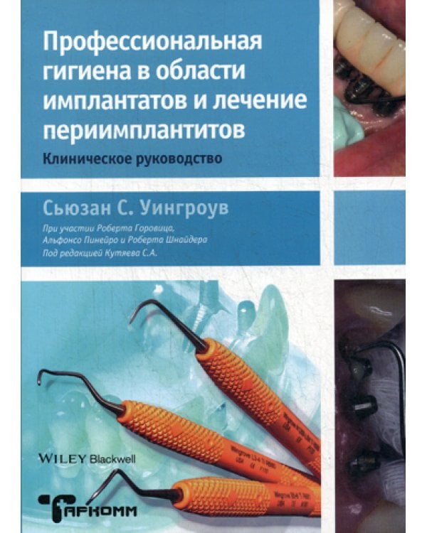 Профессиональная гигиена в области имплантатов и лечение периимплантитов. Клиническое руководство