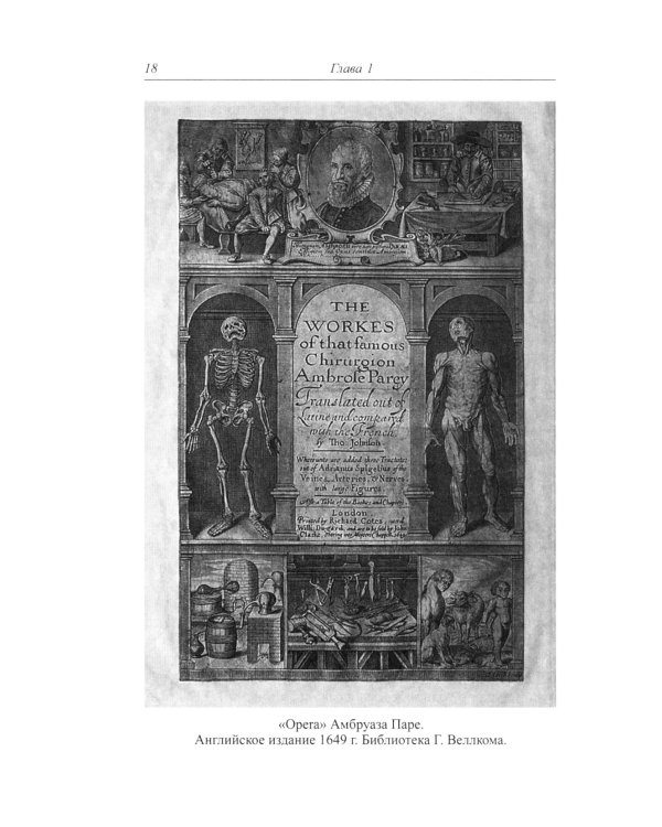 Амбруаз Паре. Первый хирург королевства