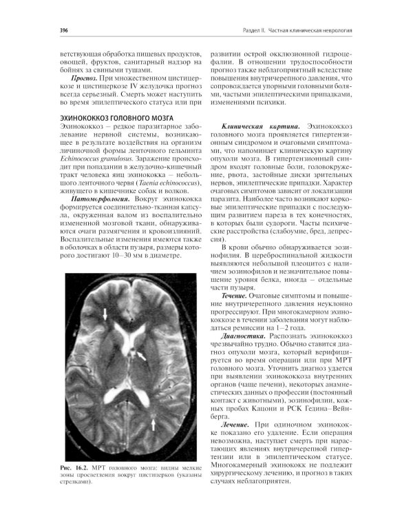 Нервные болезни: Учебник. 13-е изд