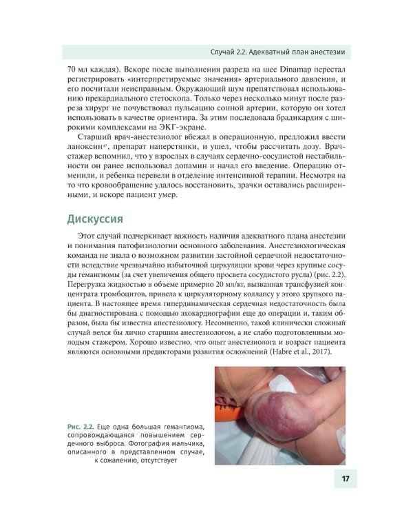 Осложнения в детской анестезиологии