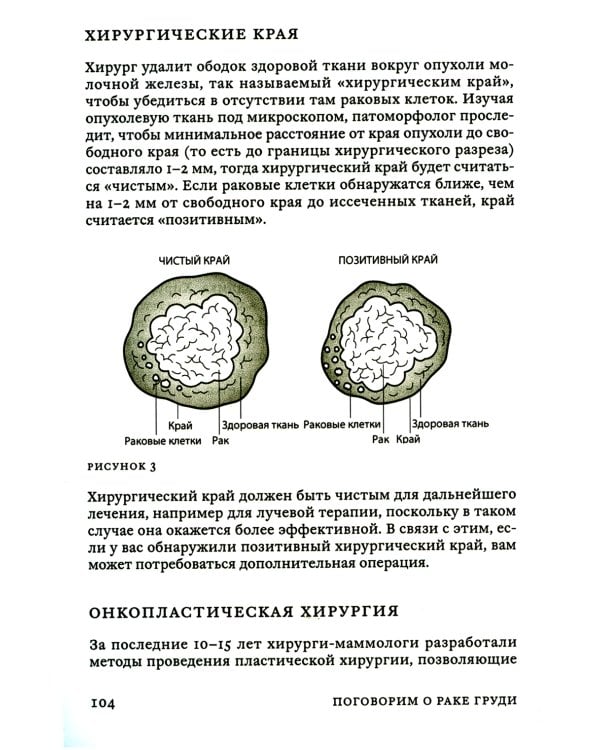 Поговорим о раке груди: Полное руководство для онкопациентов и их близких