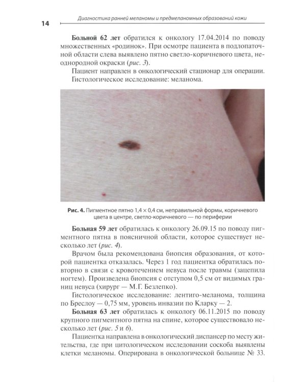 Диагностика ранней меланомы и предмеланомных образований кожи: Руководство - атлас для врачей первичного звена