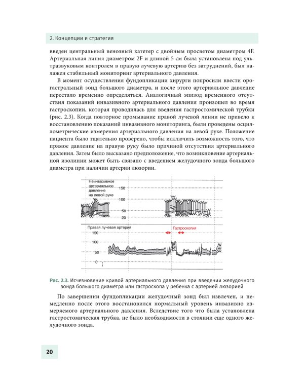 Осложнения в детской анестезиологии