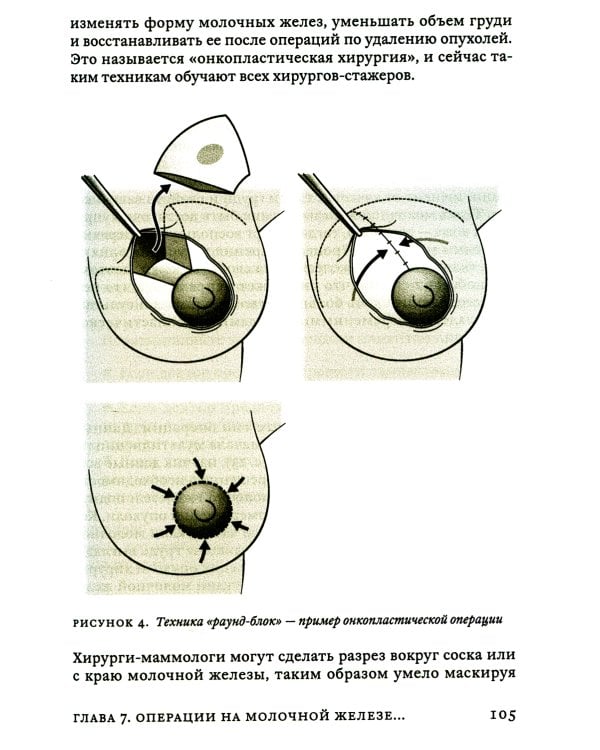 Поговорим о раке груди: Полное руководство для онкопациентов и их близких