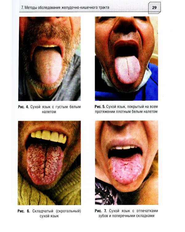 Дифференциальная диагностика диарейного синдрома в практике скорой и неотложной медицинской помощи: руководство для врачей и фельдшеров