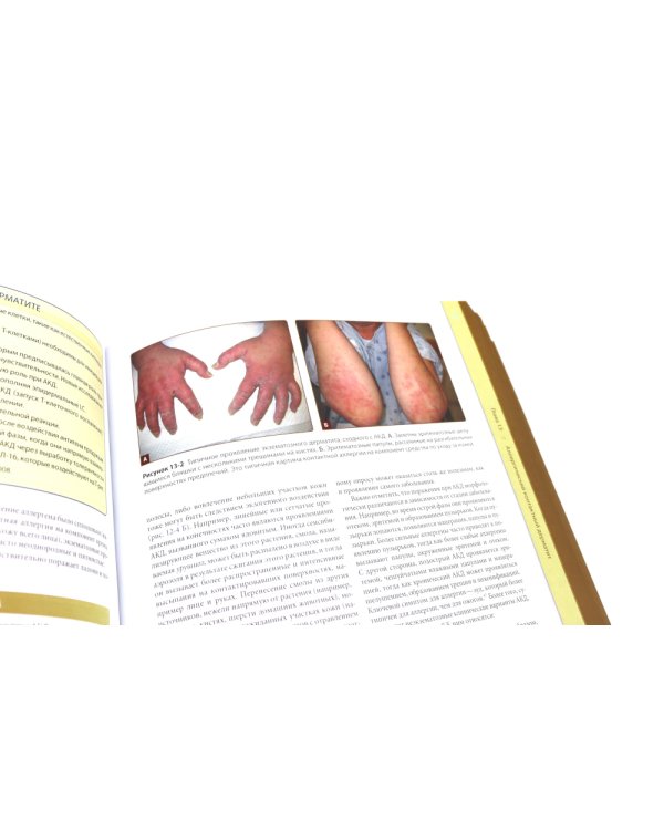 Дерматология Фицпатрика в клинической практике: Т. 1: в 2-х ч., Т. 3 (комплект из 3-х частей)