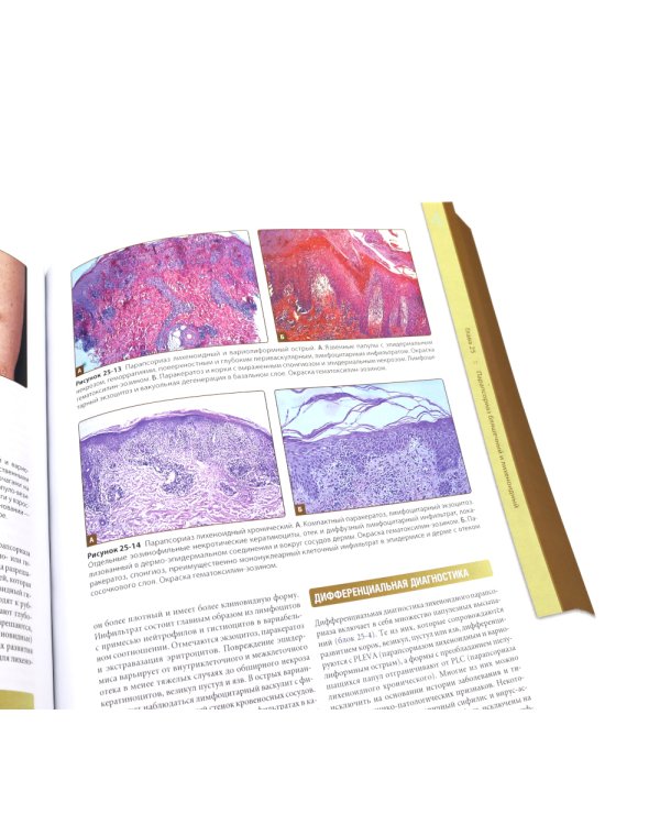 Дерматология Фицпатрика в клинической практике: Т. 1: в 2-х ч., Т. 3 (комплект из 3-х частей)