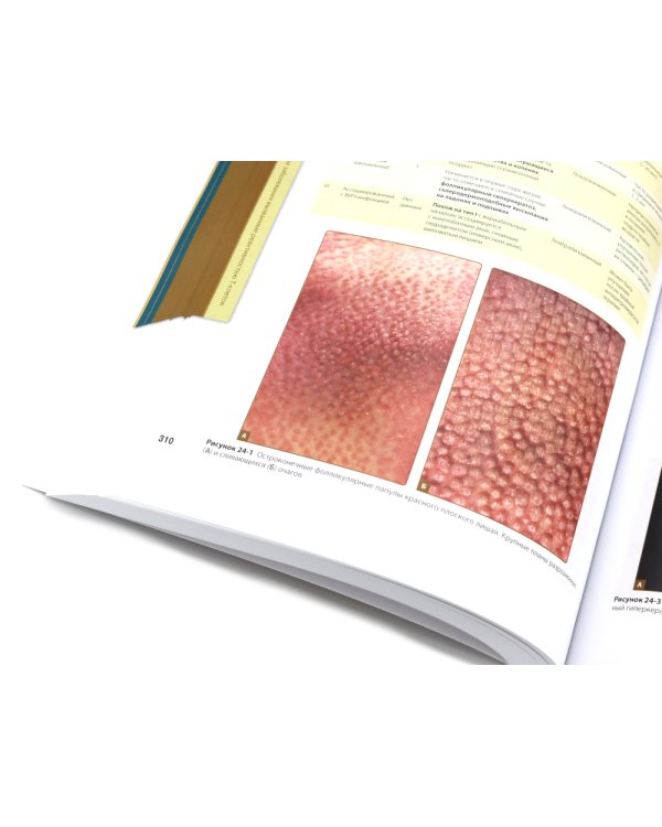 Дерматология Фицпатрика в клинической практике: Т. 1: в 2-х ч., Т. 3 (комплект из 3-х частей)