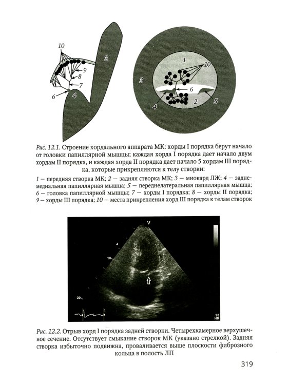 Практикум по клинической эхокардиографии: руководство для врачей