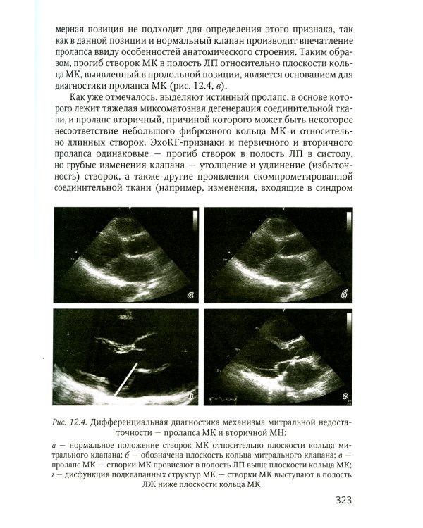 Практикум по клинической эхокардиографии: руководство для врачей