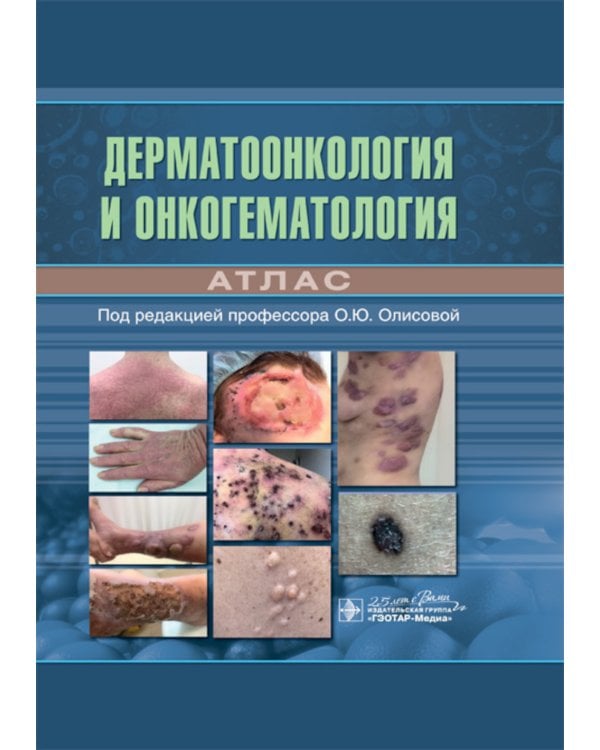 Дерматоонкология и онкогематология. Атлас