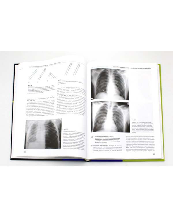 Закрытая травма грудной клетки: проблемы диагностики