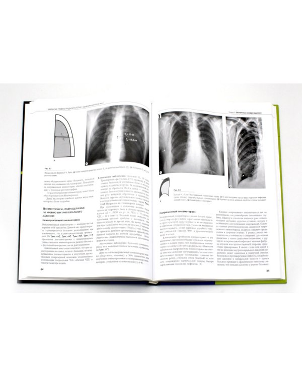 Закрытая травма грудной клетки: проблемы диагностики