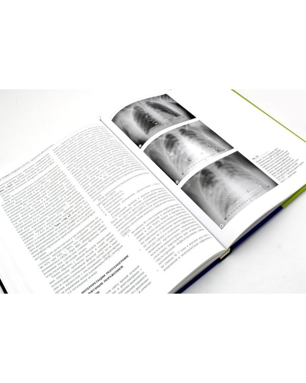 Закрытая травма грудной клетки: проблемы диагностики