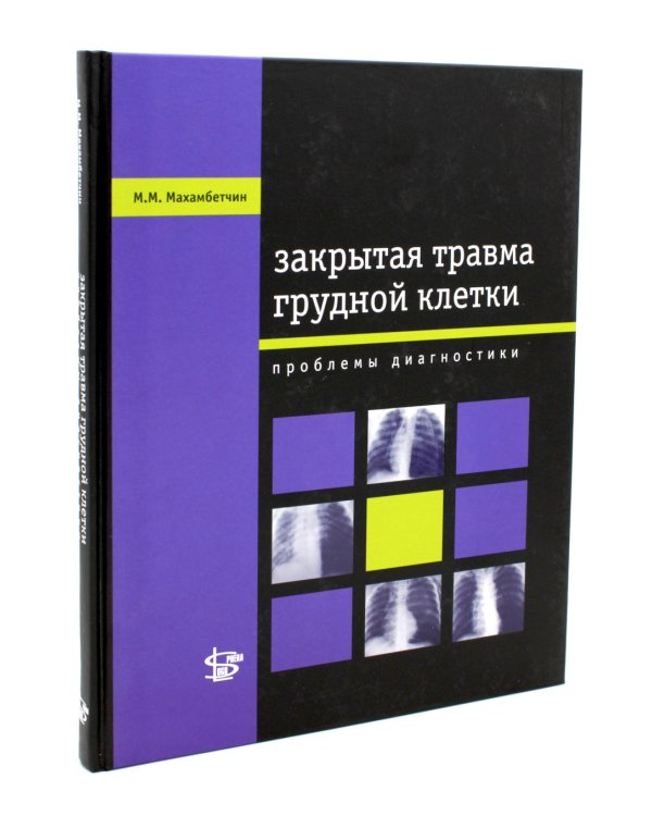 Закрытая травма грудной клетки. Проблемы диагностики