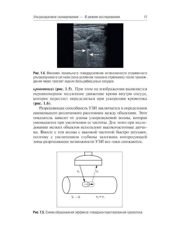 Ультразвуковая диагностика болезней вен. 4-е изд., перераб. и доп