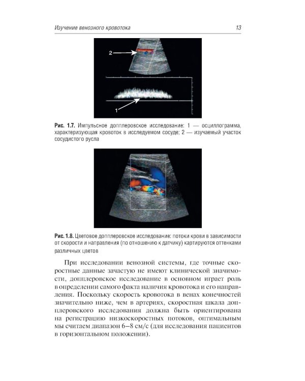 Ультразвуковая диагностика болезней вен. 4-е изд., перераб. и доп