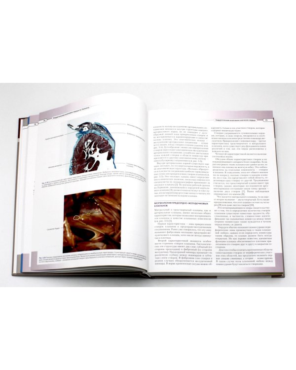 Хирургическая анатомия сердца по Уилкоксу