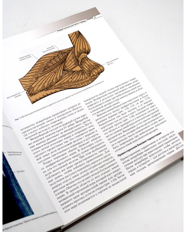 Хирургическая анатомия сердца по Уилкоксу