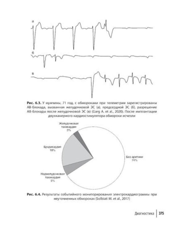 Аритмии сердца: руководство для врачей. 10-е изд., перераб. и доп