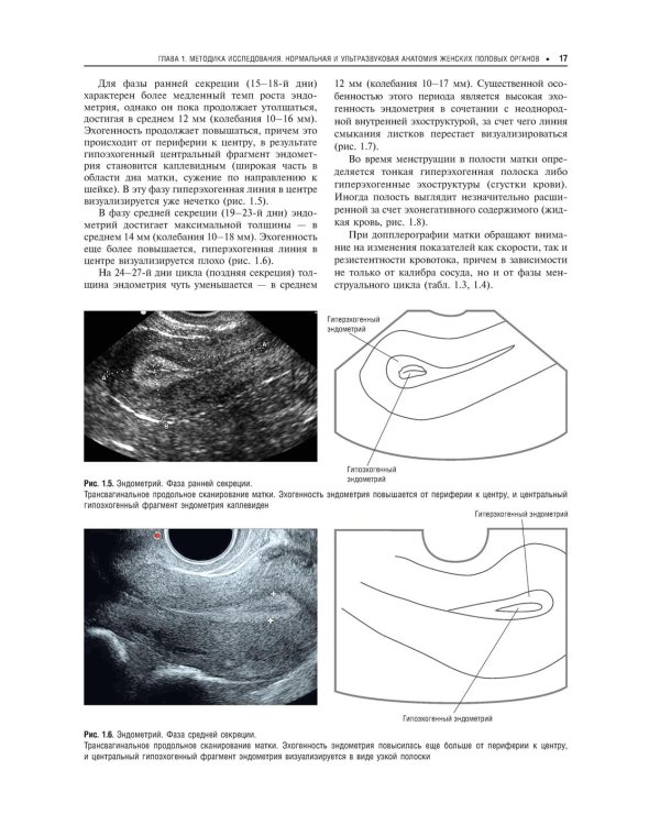 Практическая ультразвуковая диагностика. Руководство для врачей. В 5 т. Т. 3. Ультразвуковая диагностика заболевания женских половых органов