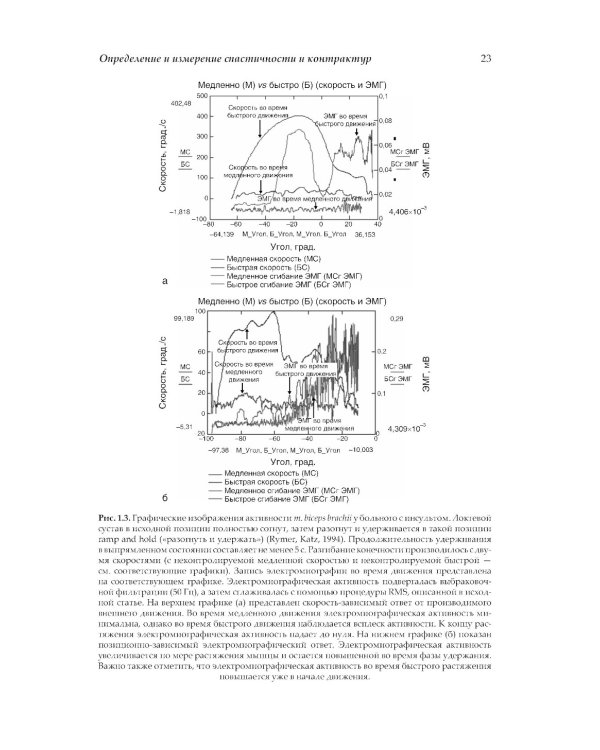 Нейрореабилитация. Спастичность и контрактуры в клинической практике и исследованиях