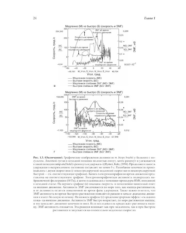 Нейрореабилитация. Спастичность и контрактуры в клинической практике и исследованиях