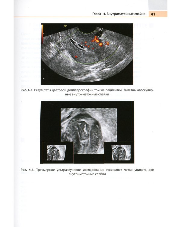 Актуальные проблемы акушерства и гинекологии: иллюстрированный справочник