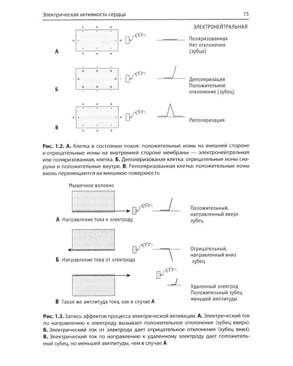 Быстрый анализ ЭКГ. 3-е изд