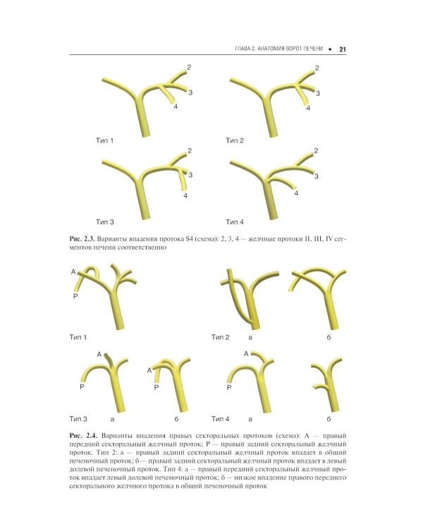 Холангиоцеллюлярная карцинома