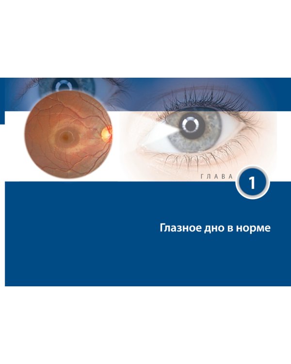 Цветной атлас сетчатки и зрительного нерва