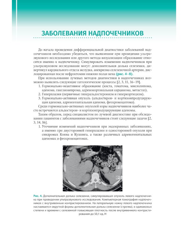 Диагностика заболеваний надпочечников с помощью КТ и МРТ