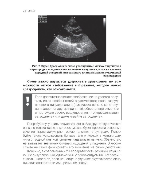 Эхокардиография для начинающих. 2-е изд., перераб. и доп
