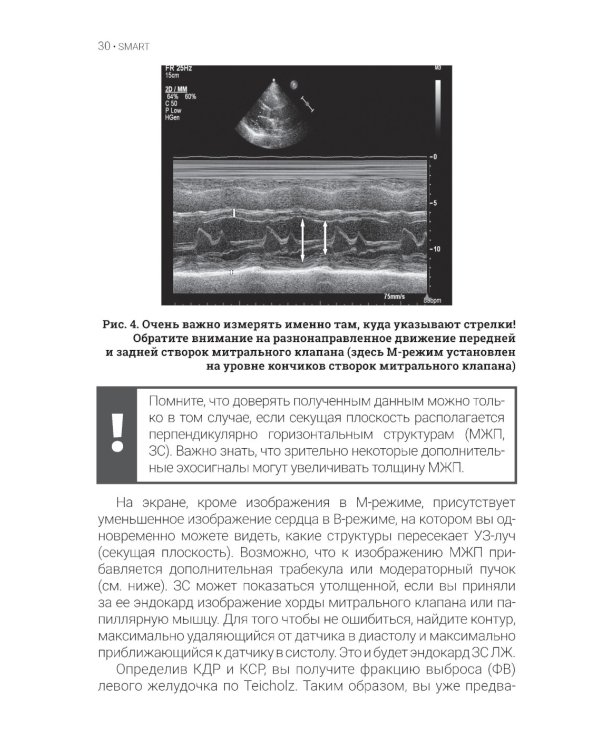 Эхокардиография для начинающих. 2-е изд., перераб. и доп