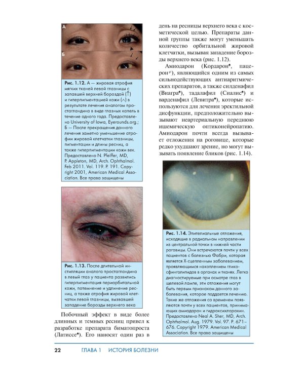 Обследование в офтальмологии