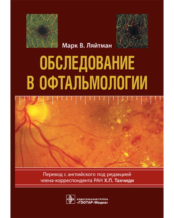 Обследование в офтальмологии