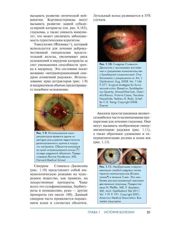 Обследование в офтальмологии