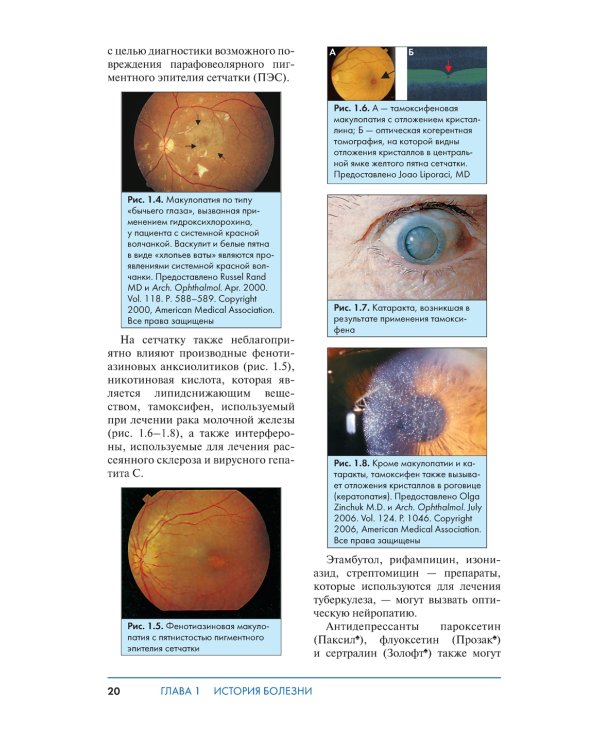 Обследование в офтальмологии