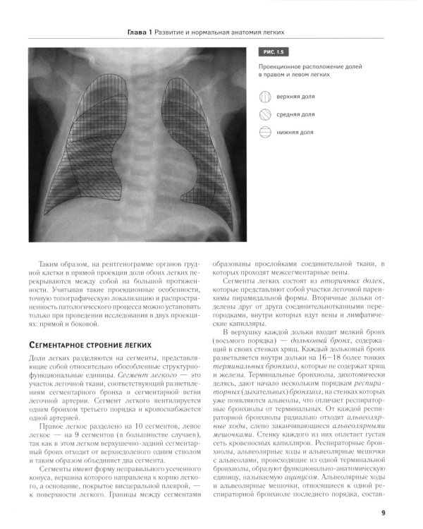 Рентгенодиагностика заболеваний легких у новорожденных и недоношенных детей: Учебное пособие