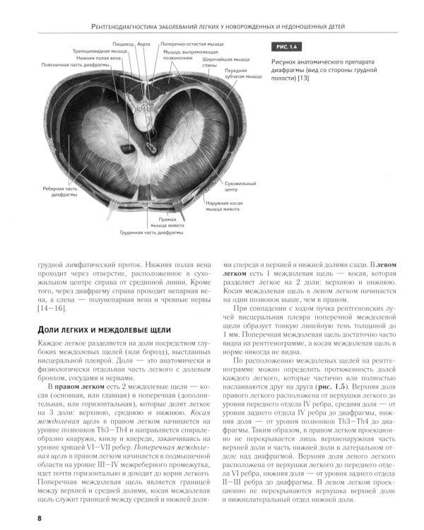 Рентгенодиагностика заболеваний легких у новорожденных и недоношенных детей: Учебное пособие