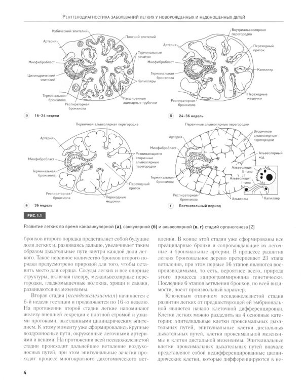 Рентгенодиагностика заболеваний легких у новорожденных и недоношенных детей: Учебное пособие